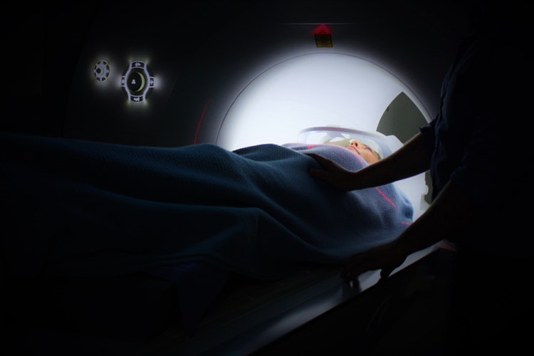 chemotherapy side effects